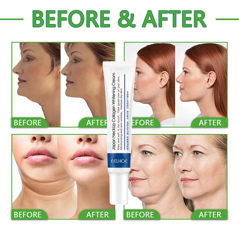 Try our Neck Collagen Whitening Cream: fades wrinkles, moisturizes, tightens, and reduces fine lines for youthful skin.