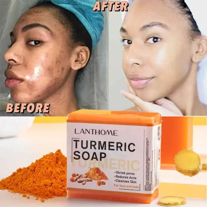 Handmade Turmeric Soap for Face Cleansing: Anti-Acne, Whitening, and Skin Lightening Properties, Helps Remove Pimples and Dark Spots, Infused with Ginger for Added Benefits.